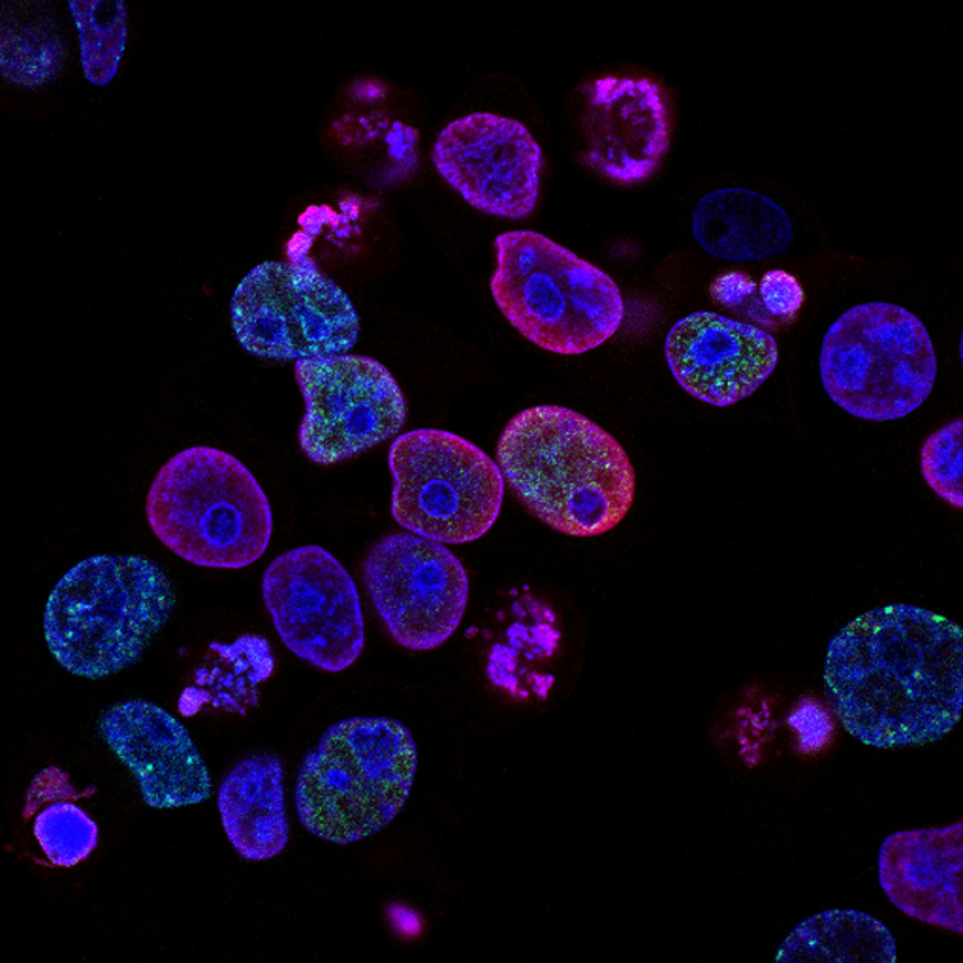 Analyse microbiologique au microscope dans le laboratoire LABSCO